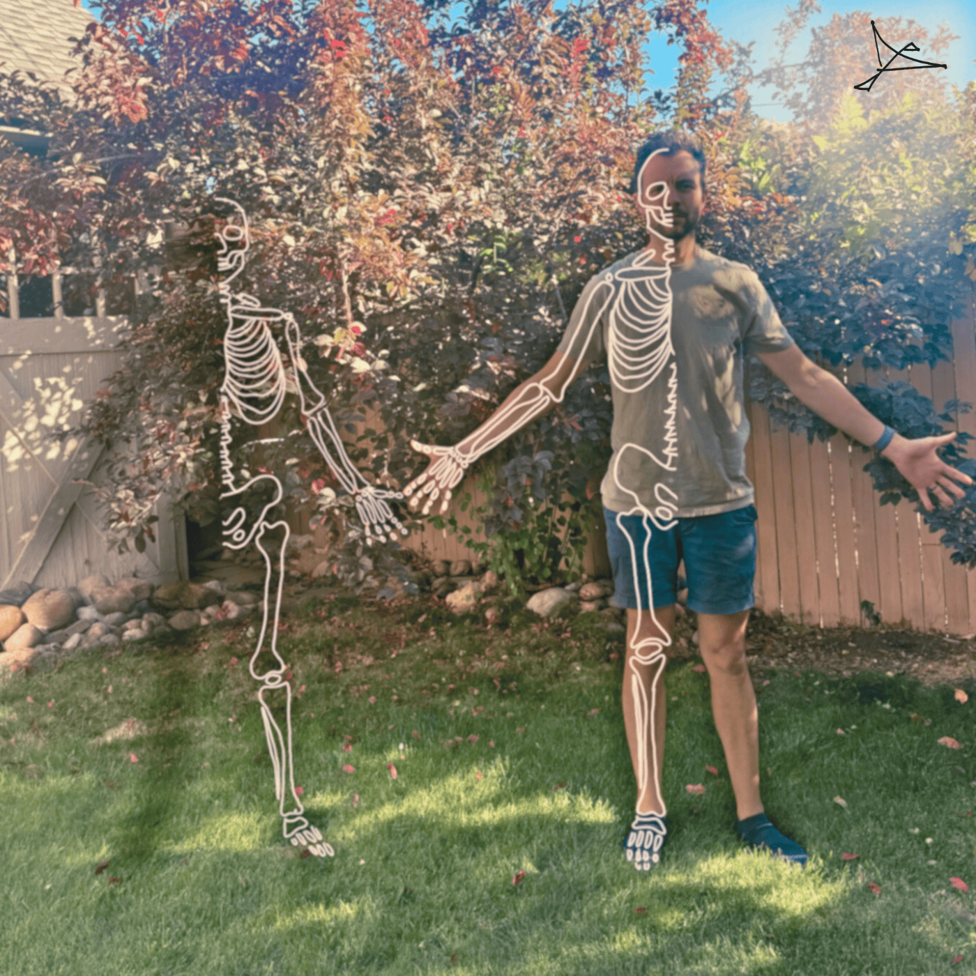 Bones